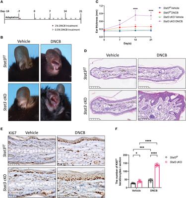 Epidermal keratinocyte-specific STAT3 deficiency aggravated atopic dermatitis-like skin inflammation in mice through TSLP upregulation